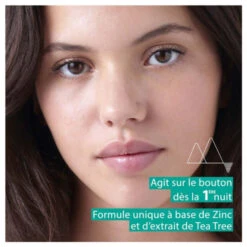 URIAGE Hyseac Pâte Sos Soin Local, 15G -Para Magasin hyseac pate sos soin local 15g 2