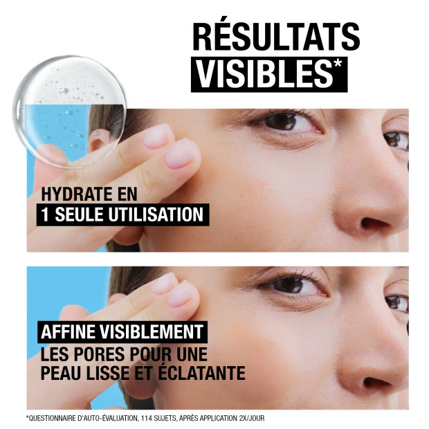 Neutrogena Sérum Hydro Boost 10% Niacinamide Flacon Pipette Compte-goutte, 30ml 5 Neutrogena Sérum Hydro Boost 10% Niacinamide Flacon Pipette Compte-goutte, 30ml – Image 5