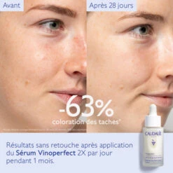 Caudalie Vinoperfect Sérum Éclat Anti-Taches, 30ml 11 Caudalie Vinoperfect Sérum Éclat Anti-Taches, 30ml -Para Magasin vinoperfect serum eclat anti taches 30ml 4